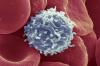 Forskere har funnet en måte, forårsaker T-cellene til å begynne å bekjempe kreft