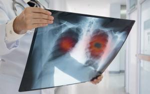 Røntgenbilder: hva dose for mennesker er farlig?