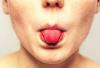 Kreft i tungen: faresignalene