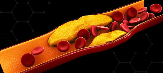 Kolesterol - cholesterin