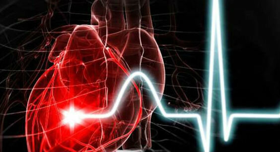 Infarkt - hjerteinfarkt
