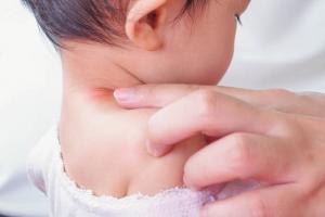 Ringorm er et barn: kilder til infeksjon, symptomer og behandling