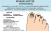 Hvordan bli kvitt soppinfeksjon på neglene
