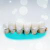 Populære splinting tenner: hvor mye det effektivt?