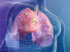 Tumoren i lungen: 5 skilt