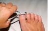 Hvordan barbere uten problemer stive, fortykket tåneglene. Tips lesere