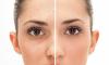4 kraftige verktøy for å bli kvitt porene i ansiktet