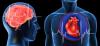 Hjerteinfarkt og hjerneslag: 7 store feil at de provoserer
