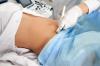Hvor ofte trenger du å gjøre ultralyd under graviditet, sier legen