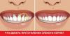 Hvordan å behandle tannkjøttet når tennene blir nakne halsen?